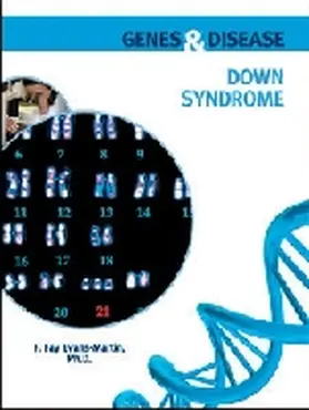 Evans-Martin |  Down Syndrome | Buch |  Sack Fachmedien