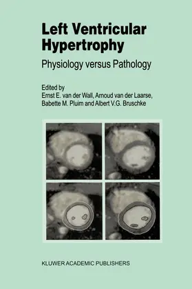 van der Wall / Bruschke / van der Laarse |  Left Ventricular Hypertrophy | Buch |  Sack Fachmedien
