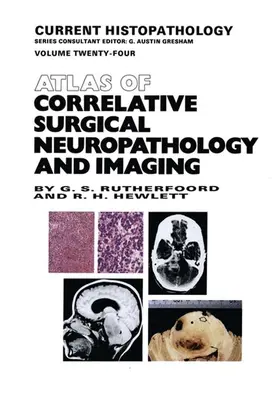 Rutherfoord / Hewlett |  Atlas of Correlative Surgical Neuropathology and Imaging | Buch |  Sack Fachmedien