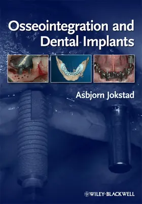 Jokstad | Osseointegration and Dental Implants | Buch | 978-0-8138-1341-7 | sack.de