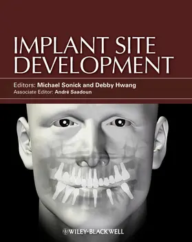 Sonick / Hwang | Implant Site Development | Buch | 978-0-8138-2512-0 | sack.de