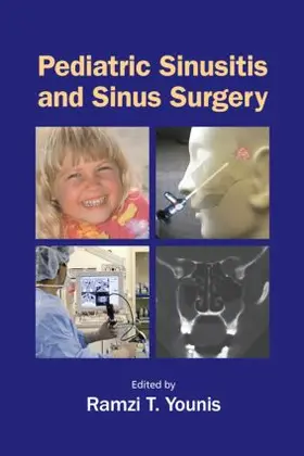 Younis |  Pediatric Sinusitis and Sinus Surgery | Buch |  Sack Fachmedien