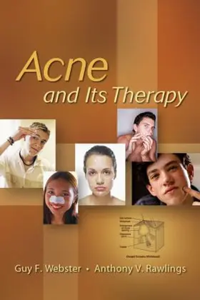 Webster / Rawlings |  Acne and Its Therapy | Buch |  Sack Fachmedien