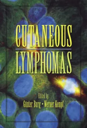 Burg / Kempf |  Cutaneous Lymphomas | Buch |  Sack Fachmedien
