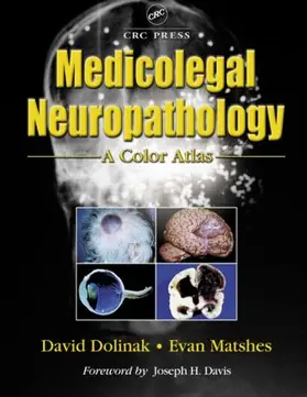 Dolinak / Matshes |  Medicolegal Neuropathology | Buch |  Sack Fachmedien