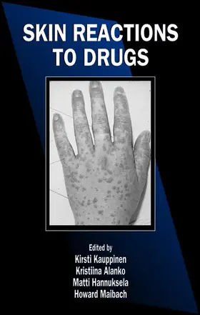 Kauppinen / Alanko / Hannuksela |  Skin Reactions to Drugs | Buch |  Sack Fachmedien