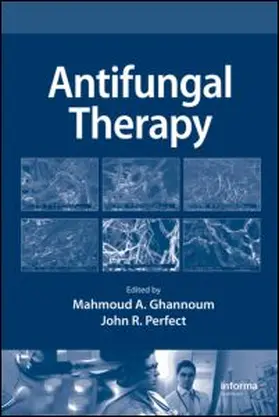 Antifungal Therapy | Buch | 978-0-8493-8787-6 | sack.de