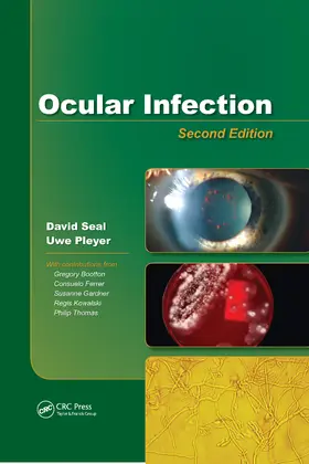 Seal / Pleyer |  Ocular Infection | Buch |  Sack Fachmedien