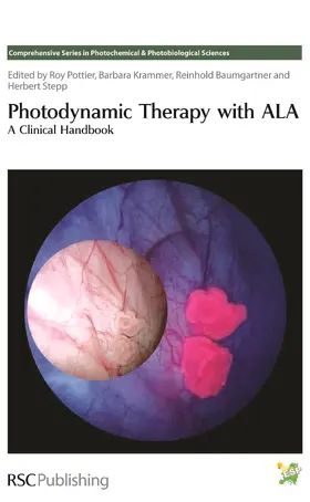 Baumgartner / Krammer / Pottier | Photodynamic Therapy with ALA | Buch | 978-0-85404-341-5 | sack.de