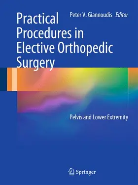 Giannoudis | Practical Procedures in Elective Orthopaedic Surgery | Buch | 978-0-85729-813-3 | www2.sack.de