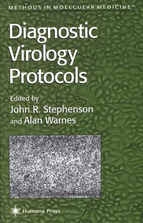 Warnes / Stephenson |  Diagnostic Virology Protocols | Buch |  Sack Fachmedien