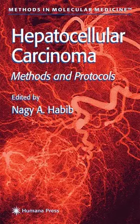 Habib |  Hepatocellular Carcinoma | Buch |  Sack Fachmedien