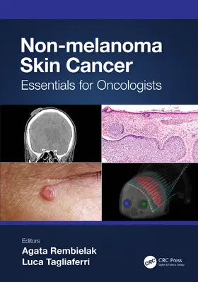 Rembielak / Tagliaferri |  Non-Melanoma Skin Cancer | Buch |  Sack Fachmedien