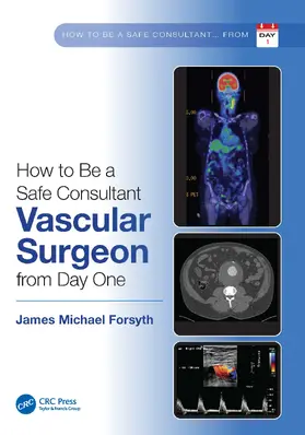 Forsyth |  How to be a Safe Consultant Vascular Surgeon from Day One | Buch |  Sack Fachmedien