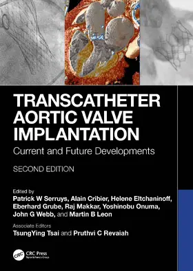 Serruys / Cribier / Eltchaninoff |  Transcatheter Aortic Valve Implantation | Buch |  Sack Fachmedien