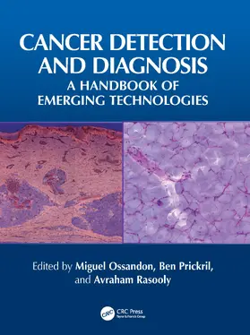 Ossandon / Prickril / Rasooly |  Cancer Detection and Diagnosis | Buch |  Sack Fachmedien