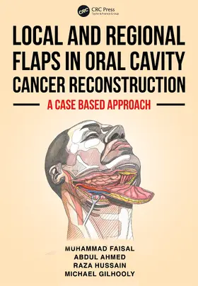 Ahmed / Faisal / Gilhooly |  Local and Regional Flaps in Oral Cavity Cancer Reconstruction | Buch |  Sack Fachmedien