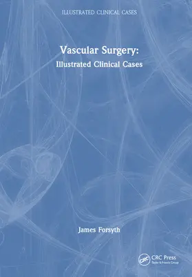 Forsyth |  Vascular Surgery: | Buch |  Sack Fachmedien