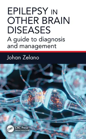 Zelano |  Epilepsy in Other Brain Diseases | Buch |  Sack Fachmedien