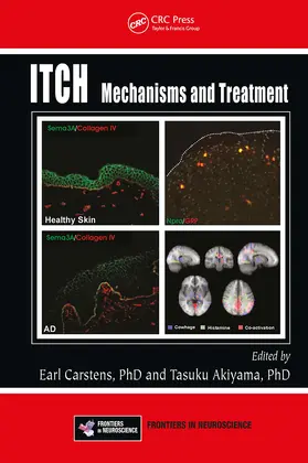 Carstens / Akiyama |  Itch | Buch |  Sack Fachmedien