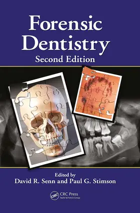 Senn / Stimson |  Forensic Dentistry | Buch |  Sack Fachmedien