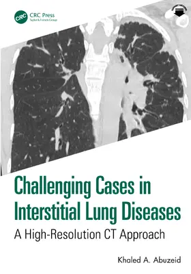 Abuzeid |  Challenging Cases in Interstitial Lung Diseases | Buch |  Sack Fachmedien