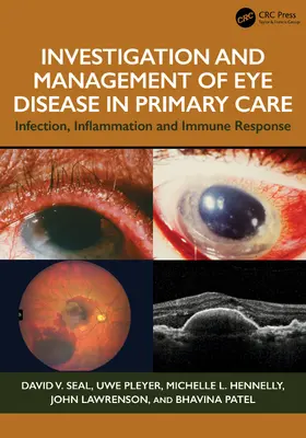 Patel / Seal / Pleyer |  Investigation & Management of Eye Disease in Primary Care | Buch |  Sack Fachmedien
