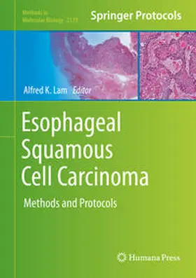 Lam |  Esophageal Squamous Cell Carcinoma | eBook | Sack Fachmedien