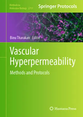 Tharakan |  Vascular Hyperpermeability | eBook | Sack Fachmedien
