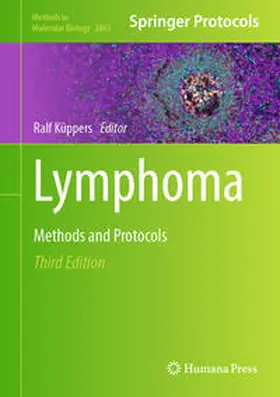 Küppers | Lymphoma | E-Book | sack.de