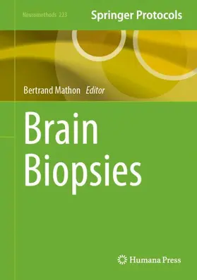 Mathon |  Brain Biopsies | Buch |  Sack Fachmedien