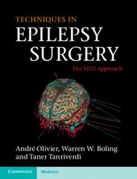 Olivier / Boling / Tanriverdi |  Techniques in Epilepsy Surgery | Buch |  Sack Fachmedien