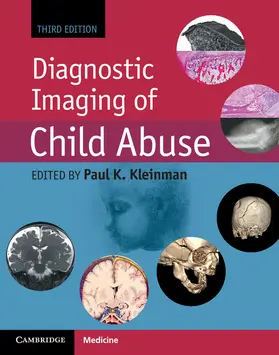 Kleinman | Diagnostic Imaging of Child Abuse | Buch | 978-1-107-01053-6 | sack.de