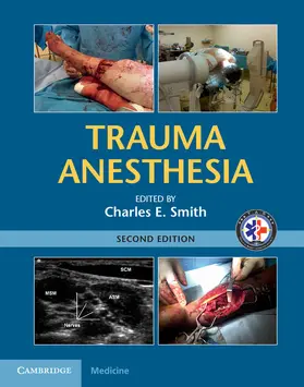 Smith | Trauma Anesthesia | Buch | 978-1-107-03826-4 | sack.de