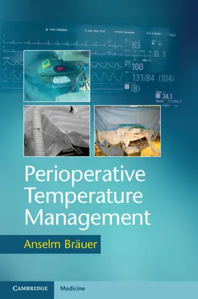 Bräuer |  Perioperative Temperature Management | Buch |  Sack Fachmedien