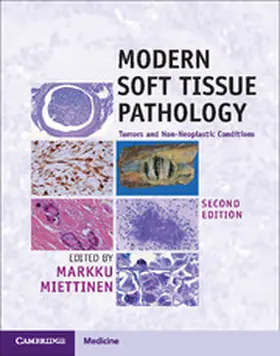 Miettinen |  Modern Soft Tissue Pathology | Buch |  Sack Fachmedien