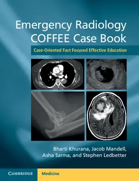 Khurana / Mandell / Sarma |  Emergency Radiology Coffee Case Book | Buch |  Sack Fachmedien