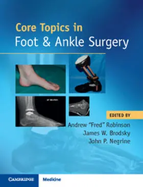 Robinson / Brodsky / Negrine |  Core Topics in Foot and Ankle Surgery | Buch |  Sack Fachmedien