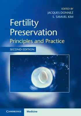 Donnez / Kim | Fertility Preservation | Buch | 978-1-108-49459-5 | sack.de