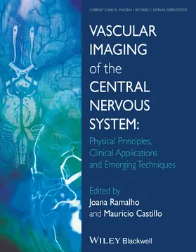 Ramalho / Castillo |  Vascular Imaging of the Central Nervous System | Buch |  Sack Fachmedien