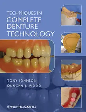 Johnson / Wood |  Techniques in Complete Denture Technology | eBook | Sack Fachmedien