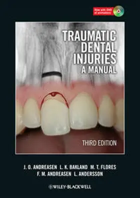 Andreasen / Bakland / Flores |  Traumatic Dental Injuries | eBook | Sack Fachmedien