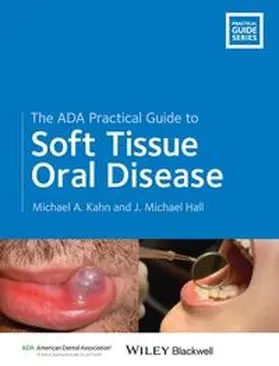 Kahn / Hall |  The ADA Practical Guide to Soft Tissue Oral Disease | Buch |  Sack Fachmedien