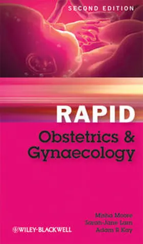 Moore / Lam / Kay |  Rapid Obstetrics and Gynaecology | eBook | Sack Fachmedien