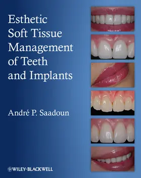 Saadoun | Esthetic Soft Tissue Management of Teeth and Implants | Buch | 978-1-118-30115-9 | sack.de