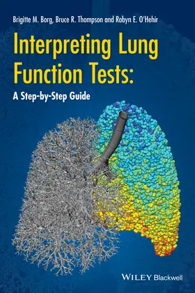 Thompson / Borg / O'Hehir |  Interpreting Lung Function Tests | Buch |  Sack Fachmedien