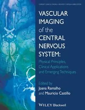 Ramalho / Castillo |  Vascular Imaging of the Central Nervous System | eBook | Sack Fachmedien