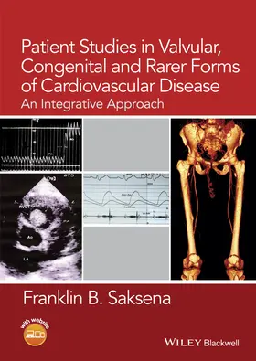 Saksena |  Patient Studies in Valvular, Congenital, and Rarer Forms of Cardiovascular Disease | Buch |  Sack Fachmedien