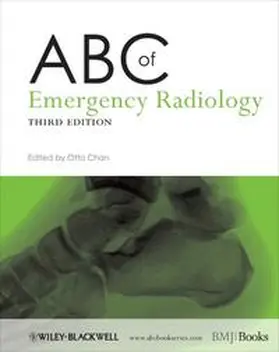 Chan |  ABC of Emergency Radiology | eBook | Sack Fachmedien