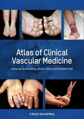Jaff / Mintz |  Atlas of Clinical Vascular Medicine | eBook | Sack Fachmedien